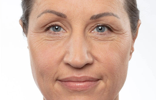 Rides du visage : Comprendre le nom des rides et leur signification